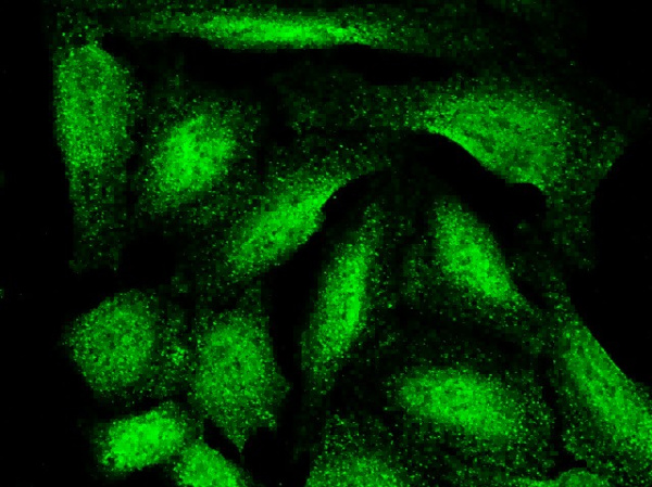 Recombinant ARL2BP/BART1 Monoclonal Antibody (AN300450P)