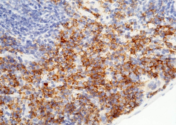 Recombinant CD64/FCGR1 Monoclonal Antibody (AN300471P)