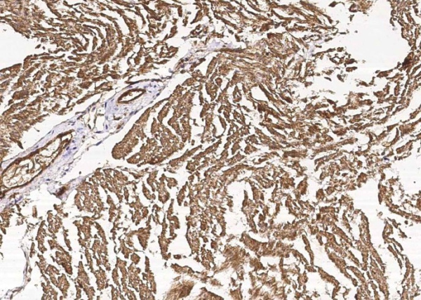 Recombinant CIB2 Monoclonal Antibody (AN300426P)