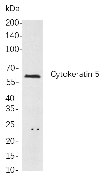 Recombinant Cytokeratin 5 Monoclonal Antibody (AN301017L)