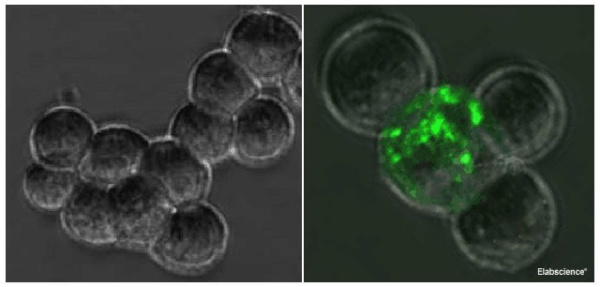 SARS-COV-2 Spike S1 Monoclonal Antibody(2019-nCoV) (E-AB-V1005)