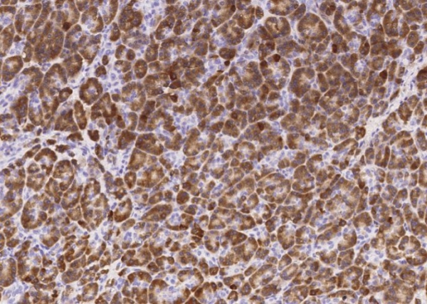 Recombinant Carboxypeptidase B1/CPB1 Monoclonal Antibody (AN300191P)