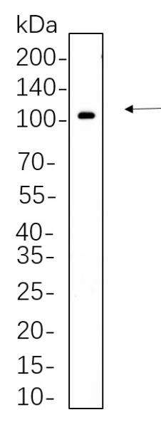 Recombinant Phospho-STAT5 (Tyr694) Monoclonal Antibody (AN300691L)