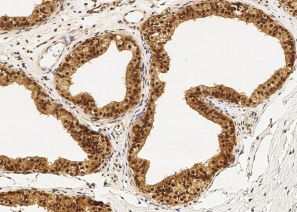 Recombinant PPIL1 Monoclonal Antibody (AN300275P)