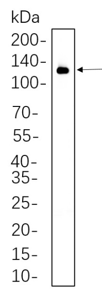 Recombinant VCAM1 Monoclonal Antibody (AN300628L)