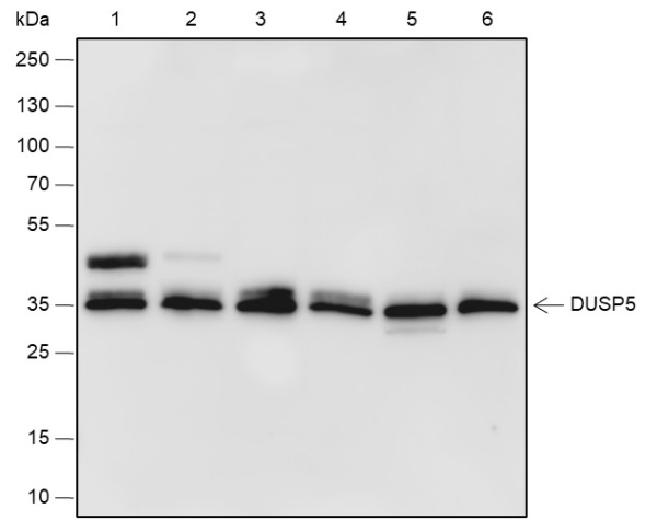 Recombinant DUSP5 Monoclonal Antibody (AN301853L)