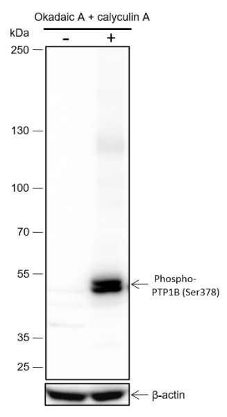 Recombinant Phospho-PTP1B (Ser378) Monoclonal Antibody (AN302081L)