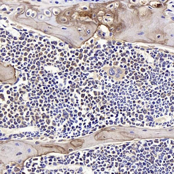SPP1 Polyclonal Antibody (E-AB-70356)