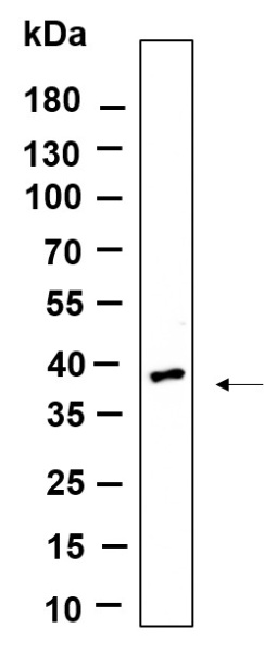 Recombinant OLIG2 Monoclonal Antibody (AN301130L)