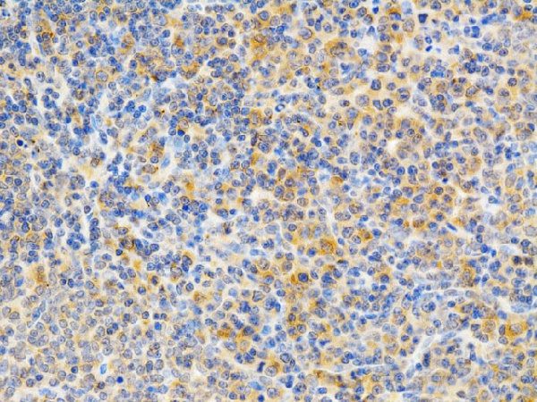 PRKCE Polyclonal Antibody (E-AB-60613)