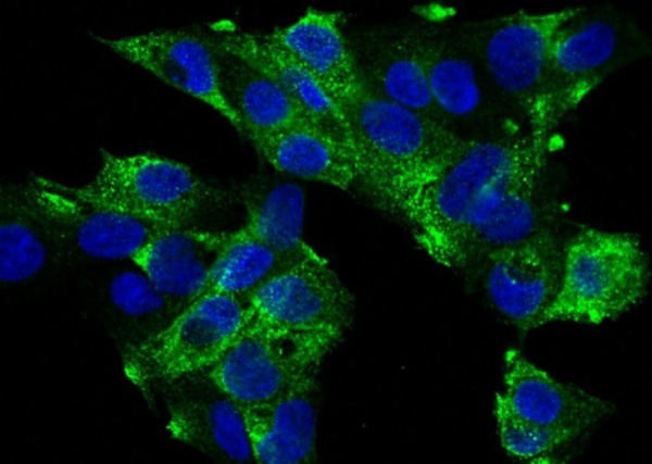 Recombinant PIGR Monoclonal Antibody (AN300080P)