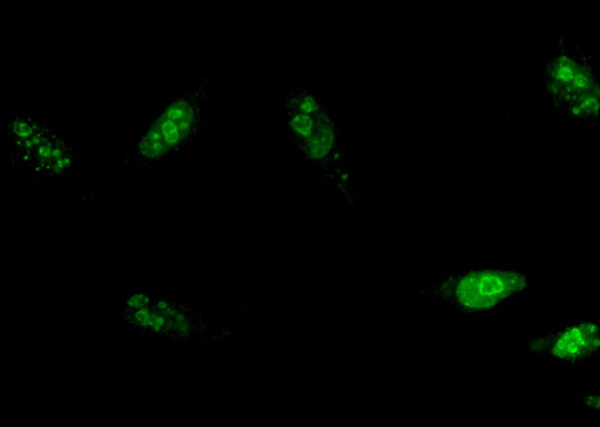MKI67 Monoclonal Antibody (AN200224P)