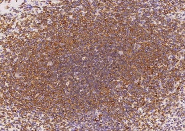 IL-6 Monoclonal Antibody (AN200102P)