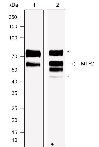 Recombinant MTF2 Monoclonal Antibody (AN302036L)