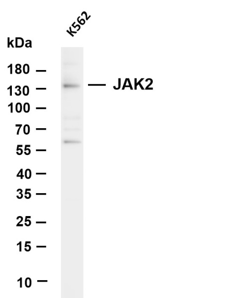 Recombinant JAK2 Monoclonal Antibody (AN300854L)