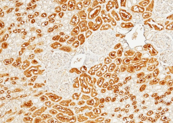 HAGH/GLO2/Glyoxalase II Monoclonal Antibody (AN200063P)