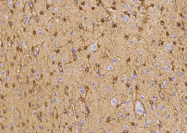 Recombinant Ezrin/villin 2 Monoclonal Antibody (AN300429P)