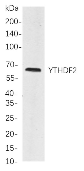Recombinant YTHDF2 Monoclonal Antibody (AN300919L)