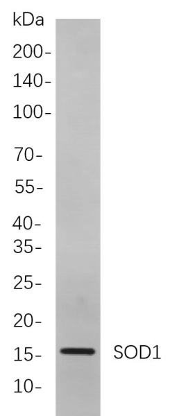 Recombinant SOD1 Monoclonal Antibody (AN300889L)