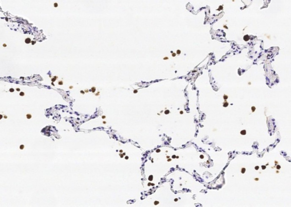 Recombinant CD68 Monoclonal Antibody (AN300041P)