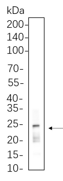 Recombinant Rab11 Monoclonal Antibody (AN301312L)