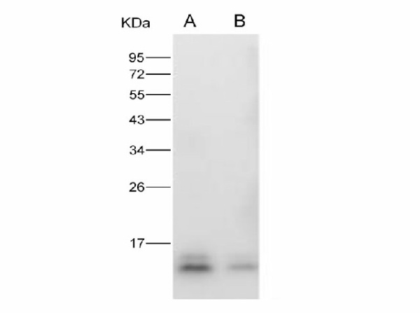 Anti-Zika virus(ZIKV)(strain Zika SPH2015) ZIKV-E/Envelope Protein Monoclonal Antibody (E-AB-V1331)