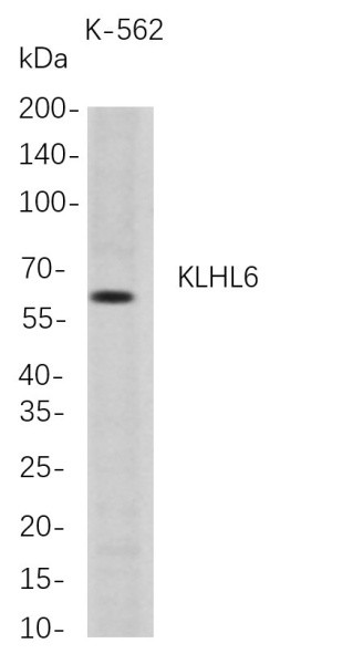 Recombinant KLHL6 Monoclonal Antibody (AN300769L)