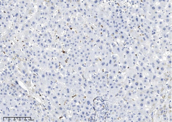 LYZ Monoclonal Antibody (AN200198P)
