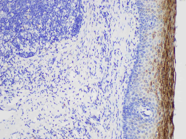 MUC1 Monoclonal Antibody (ELAB5029-M)