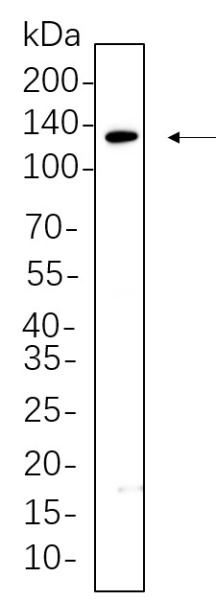Recombinant JAK1 Monoclonal Antibody (AN300646L)