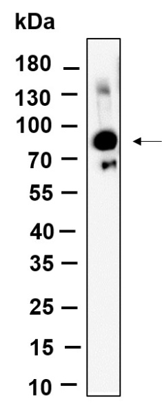 Recombinant Glyt2 Monoclonal Antibody (AN301241L)