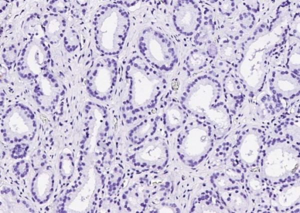 Recombinant p63(alpha) Monoclonal Antibody (AN300136P)
