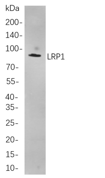 Recombinant LRP1 Monoclonal Antibody (AN301034L)