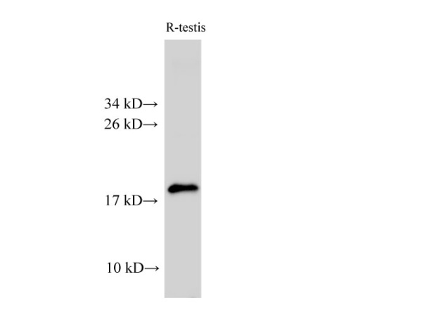 AK6 Polyclonal Antibody (E-AB-40266)