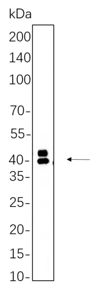 Recombinant Phospho-Erk 1, 2 (Thr202, Tyr204) Monoclonal Antibody (AN300713L)