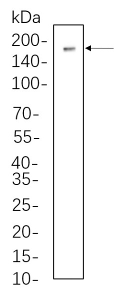 Recombinant Dnmt1 Monoclonal Antibody (AN300838L)