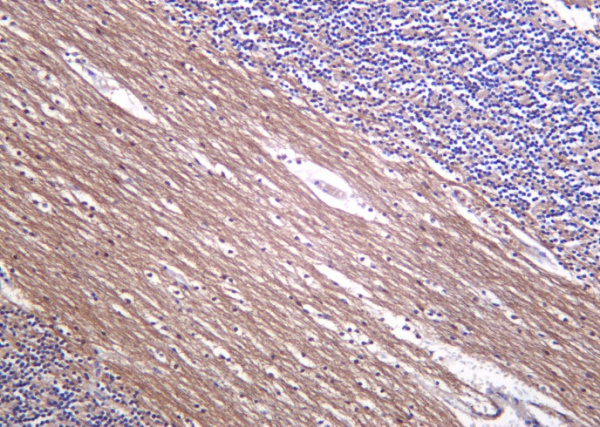 Recombinant Neurofilament (NF-L) Monoclonal Antibody (AN301288L)
