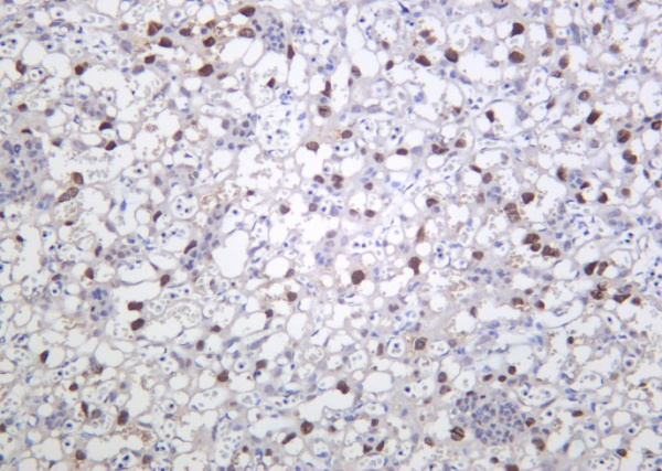 Recombinant PPAR-γ Monoclonal Antibody (AN301397L)