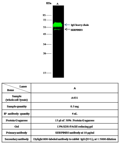 Recombinant SERPINB3/SCCA-1 Monoclonal Antibody (AN300437P)