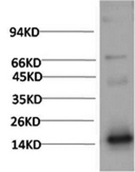 TTR Monoclonal Antibody (E-AB-22144)
