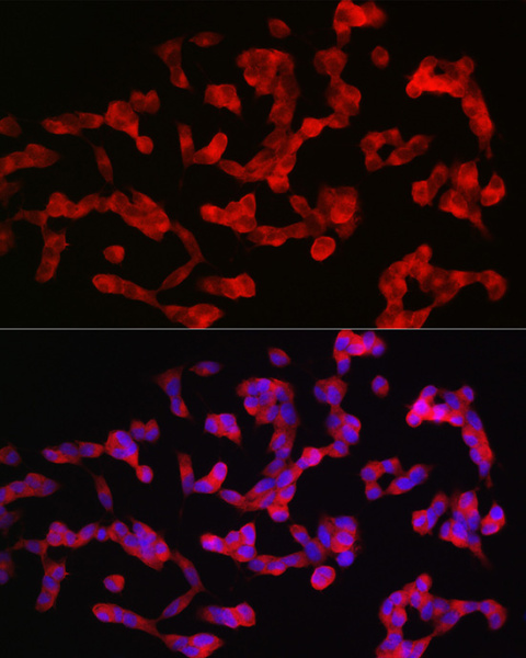 ANK3 Polyclonal Antibody (E-AB-92218)