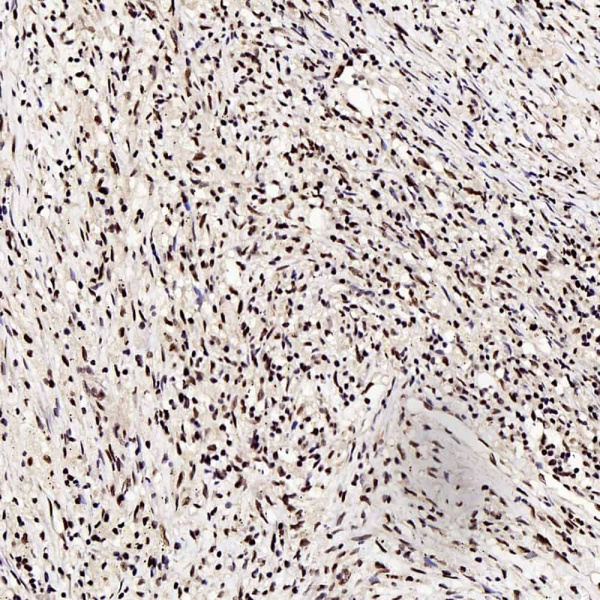 c-Fos Polyclonal Antibody (E-AB-70027)