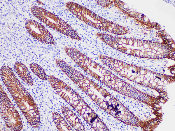 Ep-CAM（Ber-EP4） Monoclonal Antibody (ELAB6053-R)