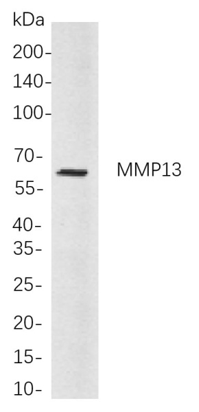 Recombinant MMP13 Monoclonal Antibody (AN301058L)