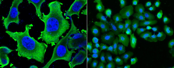 Recombinant HSP27/HSPB1 Monoclonal Antibody (AN300325P)