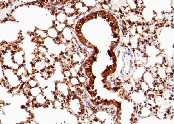 Recombinant SFTPD/SP-D/SFTP4 Monoclonal Antibody (AN300493P)