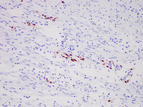 ERG Monoclonal Antibody (ELAB6926-R)