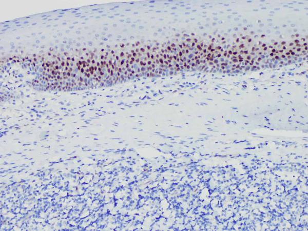 Cyclin D1 Monoclonal Antibody (ELAB6722-R)