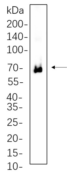 Recombinant Phospho-Zap-70 (Tyr319)/Phospho-Syk (Tyr352) Monoclonal Antibody (AN301336L)
