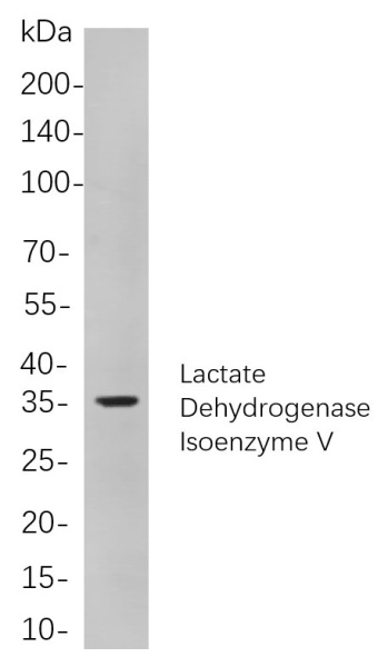 Recombinant Lactate Dehydrogenase Isoenzyme V Monoclonal Antibody (AN301095L)